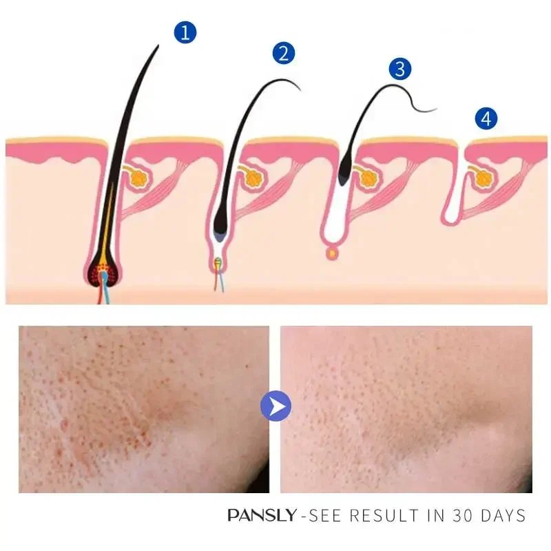 Painless Hair Removal Cream for Body, Legs & Armpits 50g - Image 4